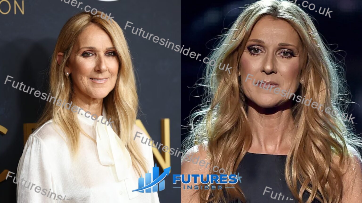 Celine Dion Disease